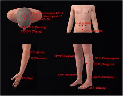 Acupuncture therapy for Parkinson’s disease: a case report demonstrating symptomatic improvement without medication